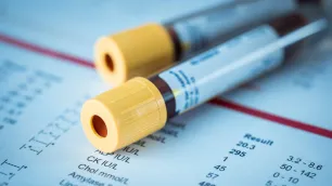 The Lifeblood of Healthcare: Why Phlebotomy is Crucial